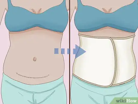 Imagen titulada Wear a Belly Bandit Step 7
