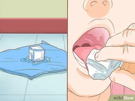 Imagen titulada Stop Tongue Bleeding Step 6
