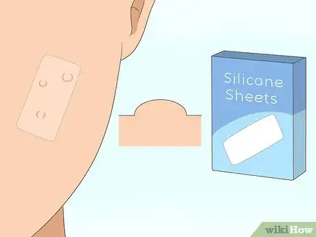 Imagen titulada Get Rid of Acne Scars Fast Step 5