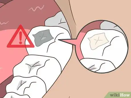 Imagen titulada Cure Lichen Planus Step 13