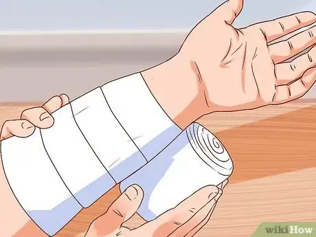 Imagen titulada Apply a Cast to a Broken Arm Step 3