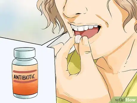 Imagen titulada Treat a Tooth Abscess Step 8