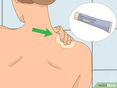 Imagen titulada Clean Your Back Step 11