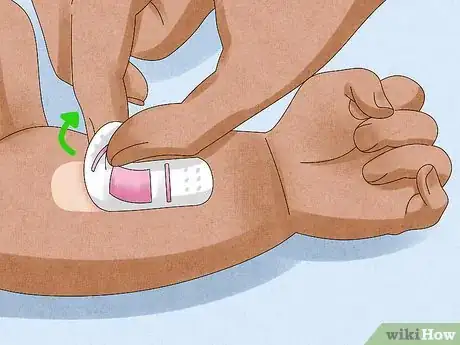 Imagen titulada Remove a Bandage from a Baby Step 6