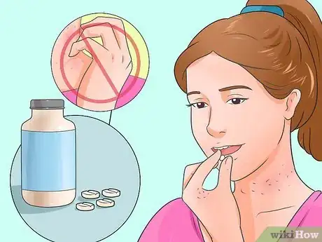 Imagen titulada Cure Scabies Step 3