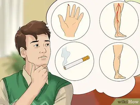 Imagen titulada Treat Dry Gangrene Step 17