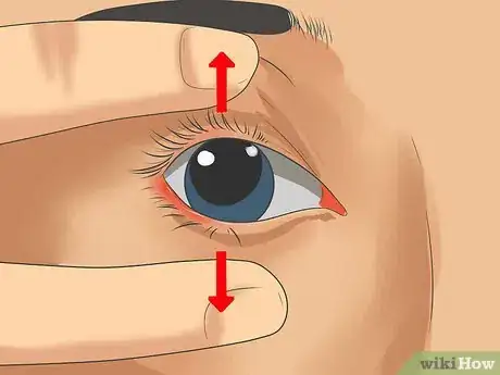 Imagen titulada Use Contact Lenses Step 14