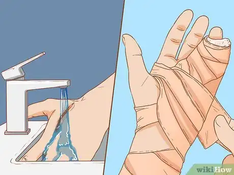 Imagen titulada Apply Different Types of Bandages Step 16