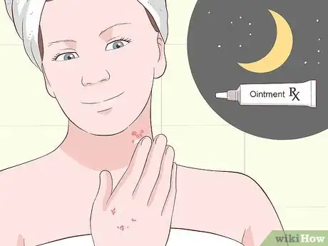 Imagen titulada Heal Scabies Scars Step 13