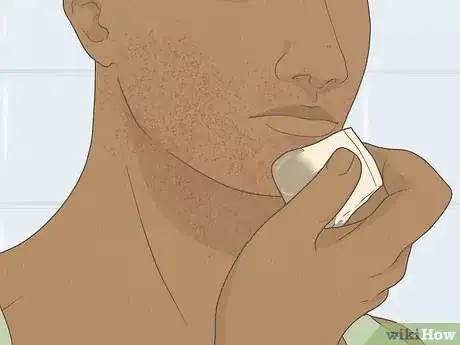 Imagen titulada Get Rid of Razor Burn Fast Step 4