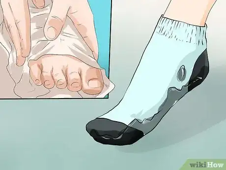 Imagen titulada Prevent the Spread of Fungal Infections Step 9