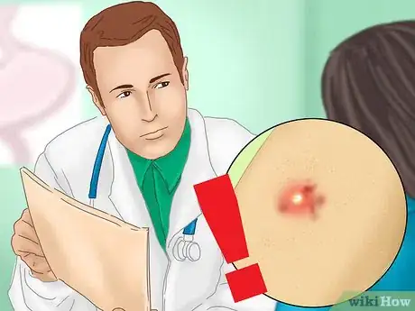 Imagen titulada Treat a Staph Infection Step 2