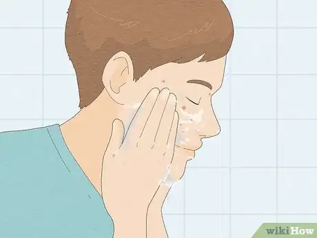 Imagen titulada Pop a Pimple Step 5