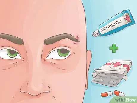 Imagen titulada Heal Piercings Step 13