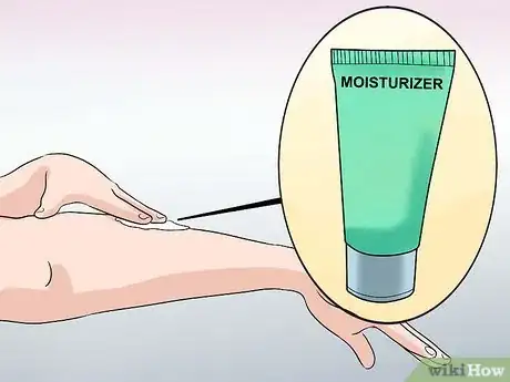 Imagen titulada Remove Keloid Scars at Home Step 1