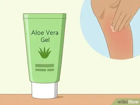 Imagen titulada Prevent Ingrown Hairs After Waxing Using Home Remedies Step 9