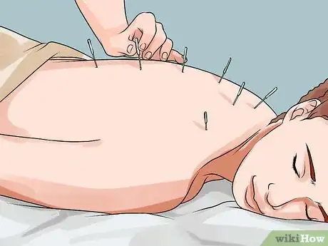 Imagen titulada Get Rid of Bad Back Pain Step 9
