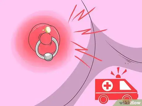Imagen titulada Treat an Infected Nipple Piercing Step 10