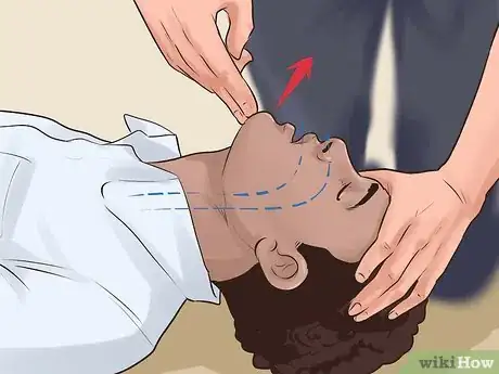 Imagen titulada Do Basic First Aid Step 8
