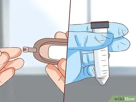 Imagen titulada Treat a Human Bite Step 13