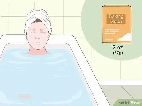 Imagen titulada Heal Scabies Scars Step 2