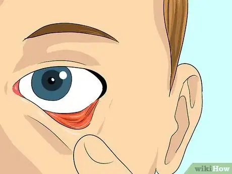 Imagen titulada Put In and Take Out Contacts Step 9