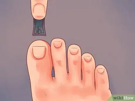 Imagen titulada Care for Your Feet and Toenails Step 11