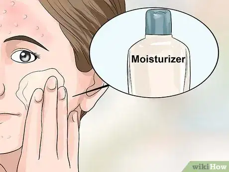 Imagen titulada Hide Pimples Step 4