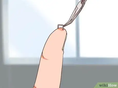 Imagen titulada Remove a Staple from Your Hand Step 3