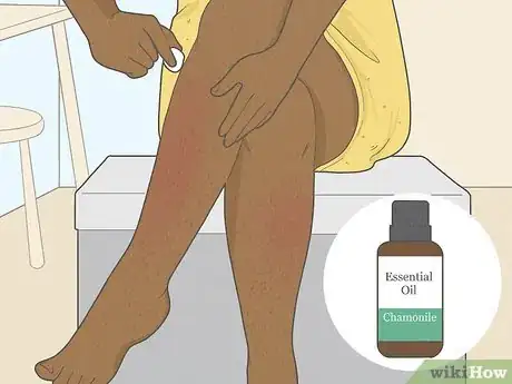 Imagen titulada Get Rid of Razor Burn Fast Step 9