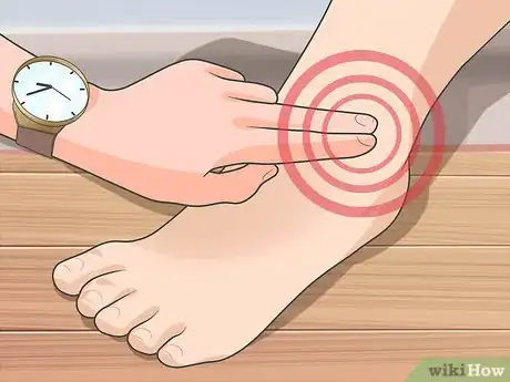 Imagen titulada Tell if a Fall Broke Bones Without an X Ray Step 7