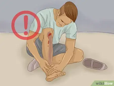 Imagen titulada Treat a Rattlesnake Bite Step 11