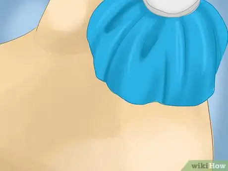 Imagen titulada Treat Raw Blisters on the Palm of Your Hand Step 6