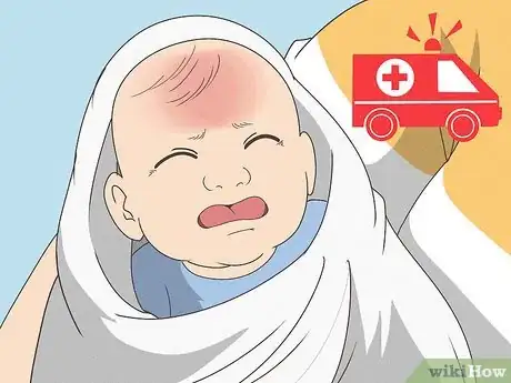 Imagen titulada Break a Fever in an Infant Step 1