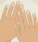 dejar de comerse las uñas