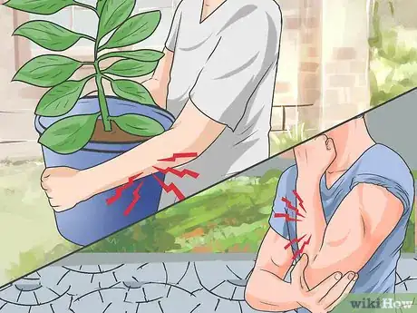 Imagen titulada Tell if a Fall Broke Bones Without an X Ray Step 6