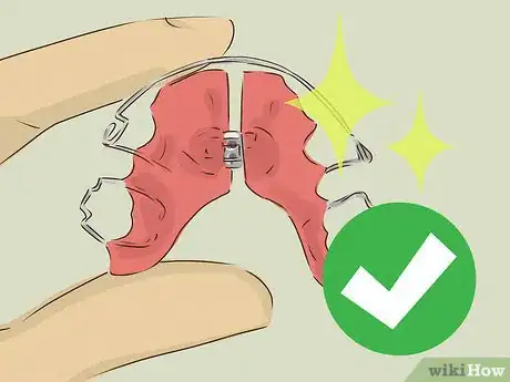 Imagen titulada Clean Your Retainer Step 11