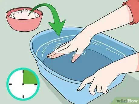 Imagen titulada Soak an Ingrown Toenail Step 1