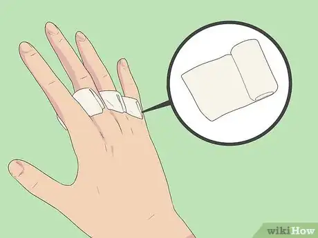 Imagen titulada Splint a Fractured Hand Step 5