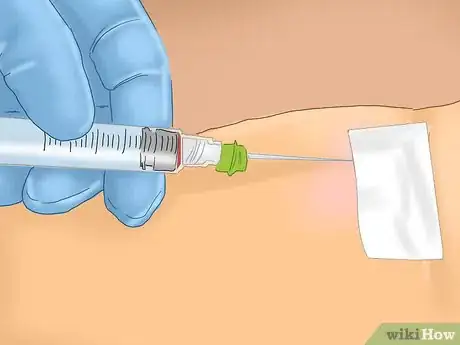 Imagen titulada Treat a Staph Infection Step 4