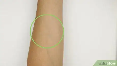 Imagen titulada Make a Fake Bruise Step 2