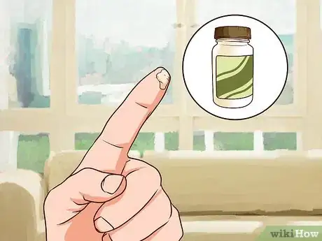 Imagen titulada Remove a Staple from Your Hand Step 5