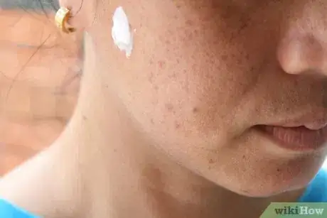 Imagen titulada Apply Toothpaste on Pimples Step 9