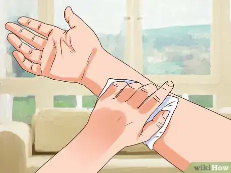 Imagen titulada Treat a Human Bite Step 3