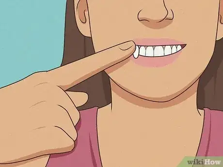 Imagen titulada Make Quick Vampire Fangs Step 6.jpeg