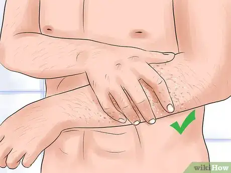 Imagen titulada Shave Your Arms Step 1