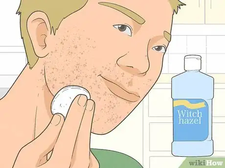 Imagen titulada Get Rid of Razor Burn Fast Step 8