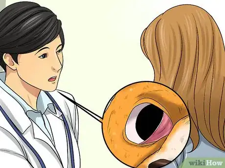 Imagen titulada Treat Third Eyelid Protrusion in Cats Step 6