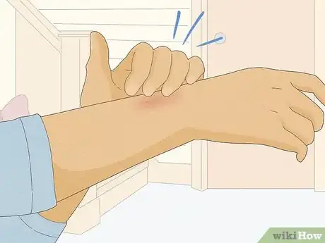Imagen titulada Remove Iodine Stains from Skin Step 5