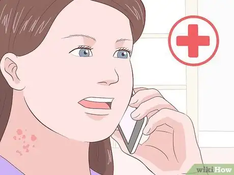 Imagen titulada Heal Scabies Scars Step 12